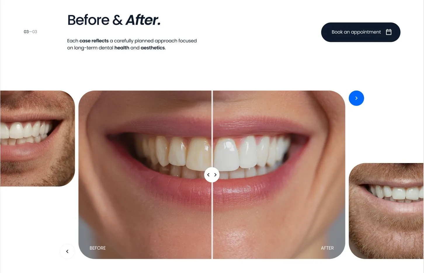 Before And After Smile Comparison — Gallery section from Behance
